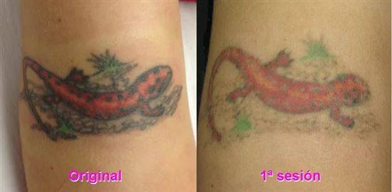 Этапы заживления Татуировки